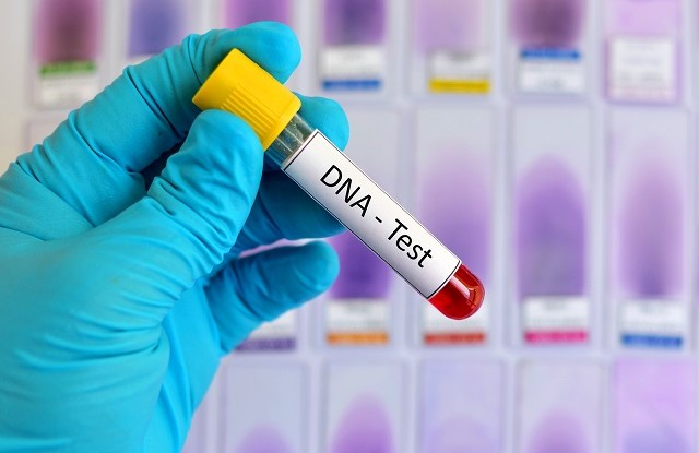  63% Of Zimbabwean Participating in DNA Test Aren't Biological Fathers