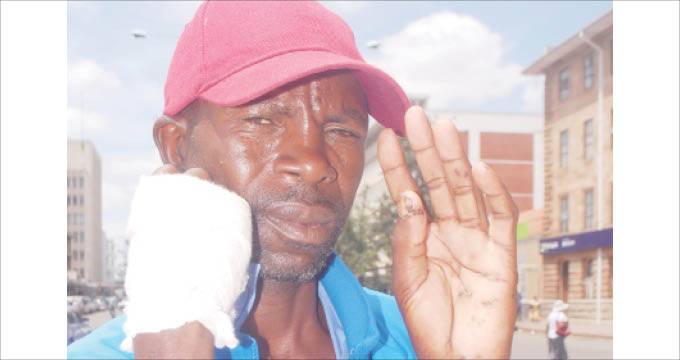 Mopane Worms Harvester Fights Off Leopard