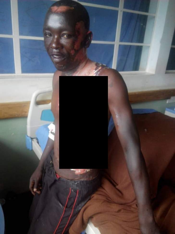 Man Scalded By Wife