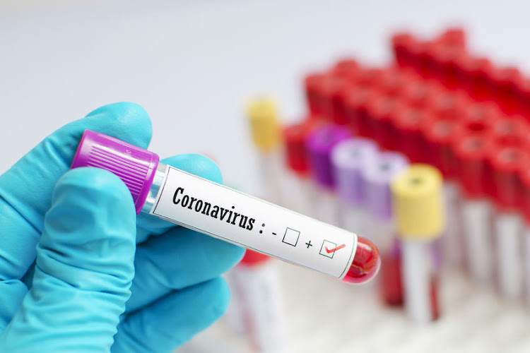 Coronavirus Zim Update