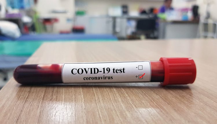 Tourism Minister Denies Vic Falls Tourist Tested Positive For Coronavirus