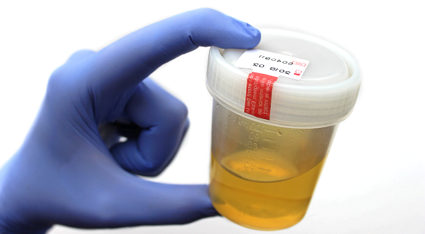 Covid-19 Natural Cure Gone Wrong: Family Duped Into Drinking Urine For Four Days 