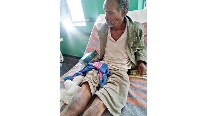 Man(74) Drags Self On His Buttocks For 8 Hours After Elephant Attack