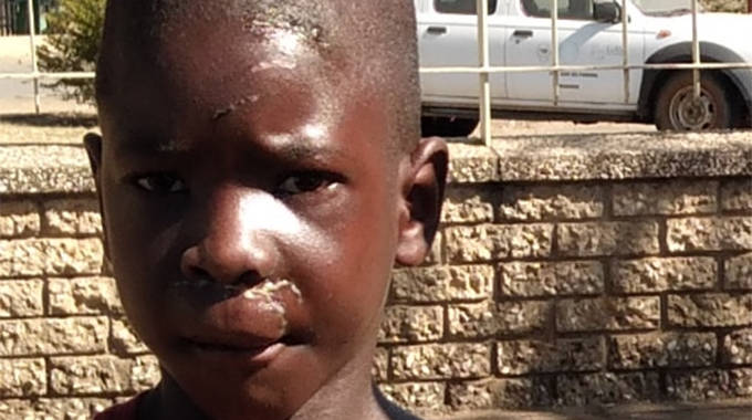 7-Year-Old Boy Undergoes Facial Construction After Attack By Three Pit-bull Dogs