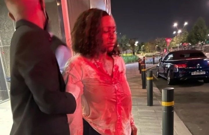 Pic: Boity Thulo's Bloodied Face Goes Viral On Social Media