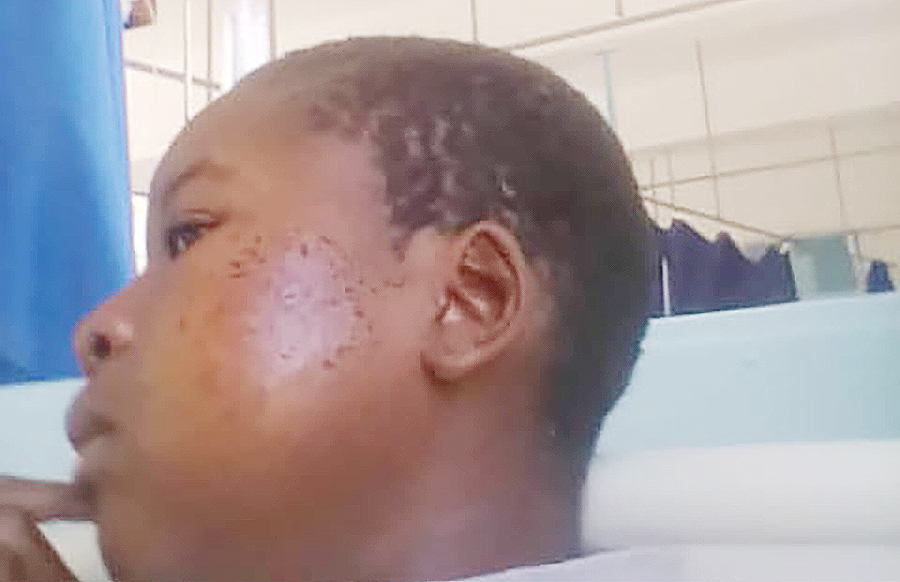 Form 3 Bulawayo Girl Shot After Cop Discharged Firearm To Stop A Fight