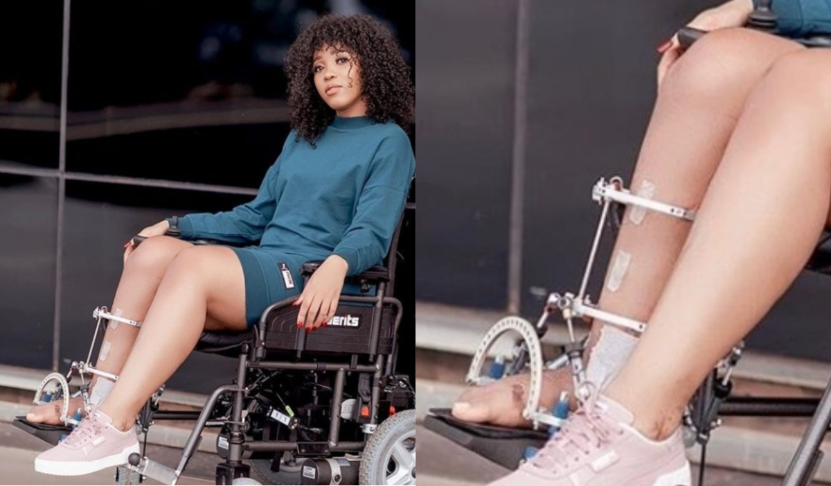 Sbahle Mpisane's Ankle Removed During Surgery